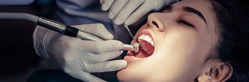 Fillings and  Painless Root Canal Treatment