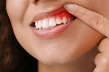 Gum Related Treatment